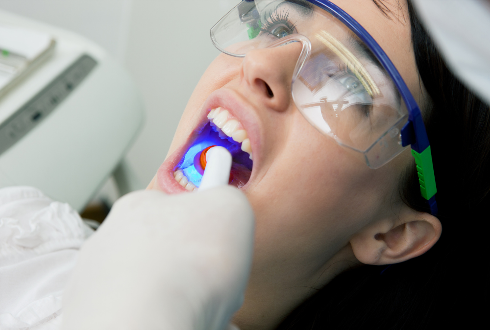 cavity fillings - blossom smiles dental