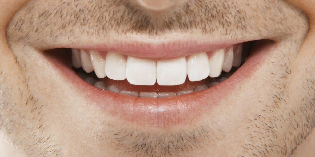 teeth with dental crowns and bridges